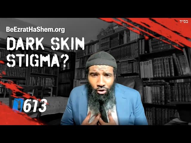 Is There A Stigma Of Being A Dark Skinned Jew?