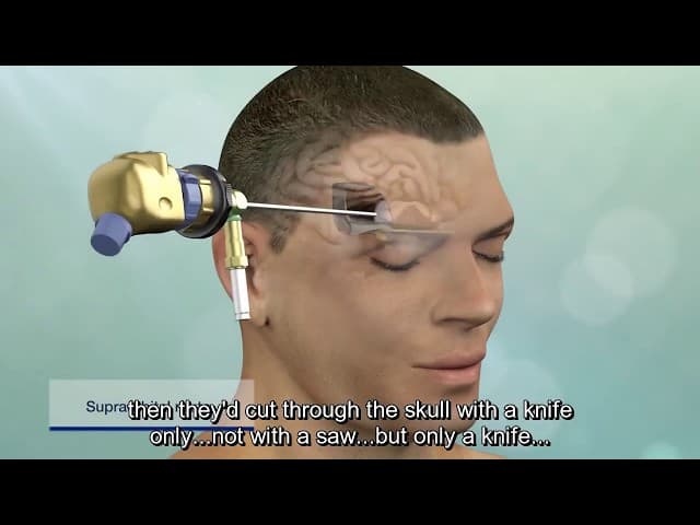 With ENGLISH SUBTITLES הוכחות בתורה על ידיעת חז"ל בחכמת הרפואה מדהים (פרק ד)  הרב אפרים כחלון